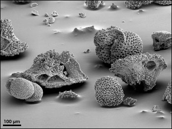 Foraminifera micrograph
